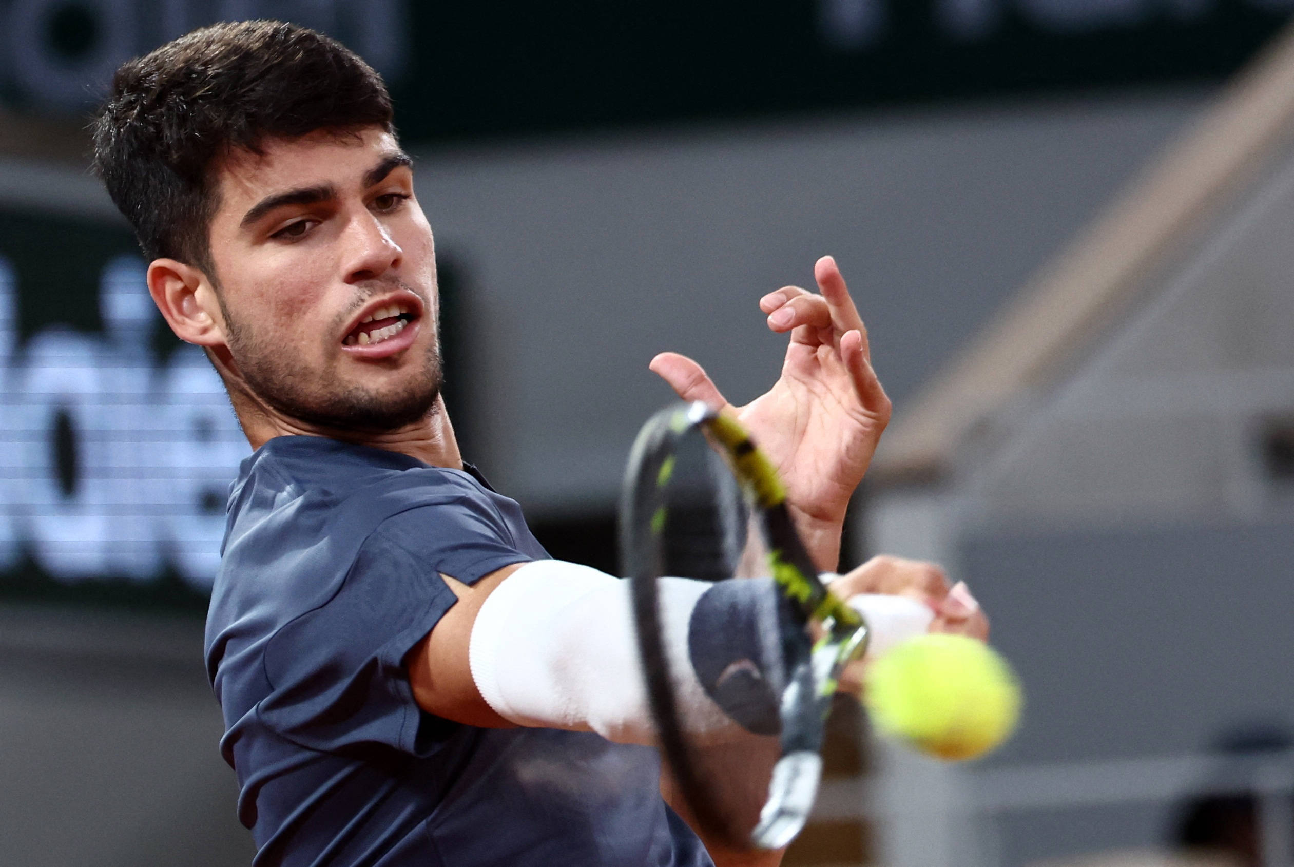 项目设置了 项目设置了